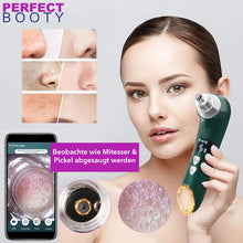 Lade das Bild in den Galerie-Viewer, Video-Porenreiniger