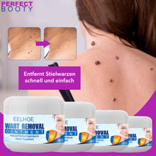 Lade das Bild in den Galerie-Viewer, Health Vital Stielwarzen Creme