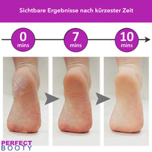 Lade das Bild in den Galerie-Viewer, Hornhautentferner