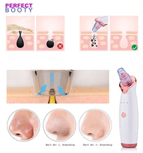 Lade das Bild in den Galerie-Viewer, Deep Pore Cleaner