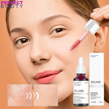 Lade das Bild in den Galerie-Viewer, Pore Minimizing Peeling