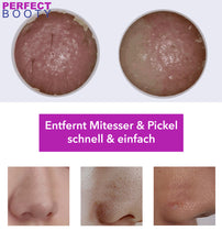 Lade das Bild in den Galerie-Viewer, Video-Porenreiniger