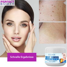 Lade das Bild in den Galerie-Viewer, Health Vital Stielwarzen Creme