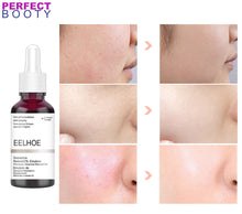 Lade das Bild in den Galerie-Viewer, Pore Minimizing Peeling