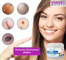 Lade das Bild in den Galerie-Viewer, Health Vital Stielwarzen Creme